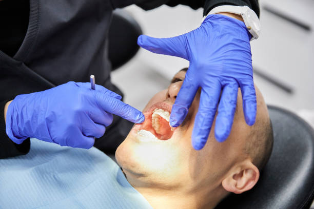 Best Emergency Dental Care for Broken or Chipped Teeth in Orida Ridge, FL